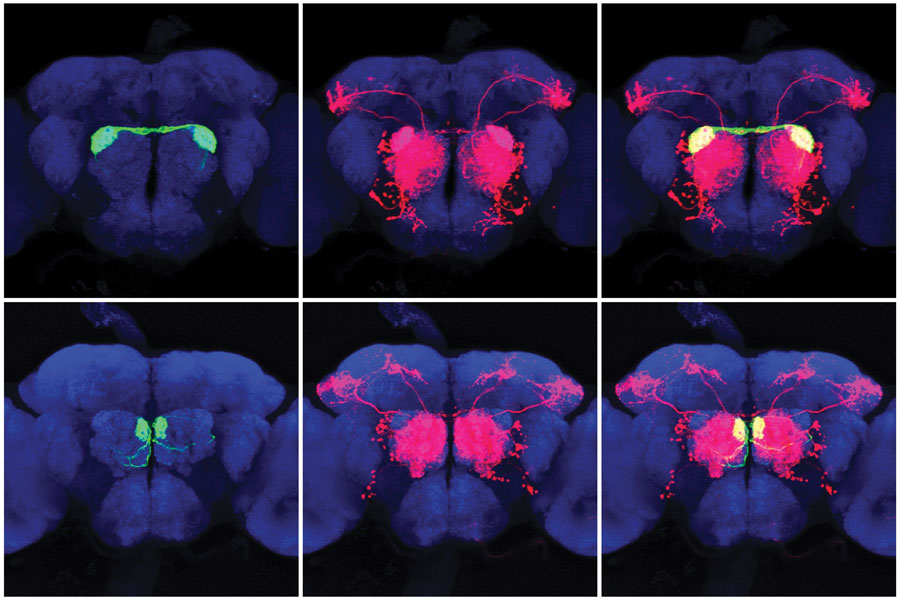 Brain scans