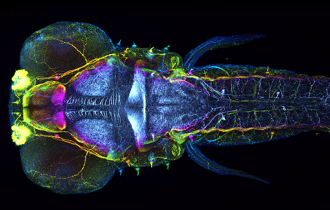 Larval zebrafish brain. Photo by Plavicki Lab