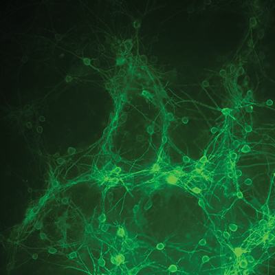 This culture of embryonic neurons glows bright green thanks to the Abdelfattah Lab’s new voltage indicators, enabling the Jaworski Lab to measure the membrane potential at the tip of axons.