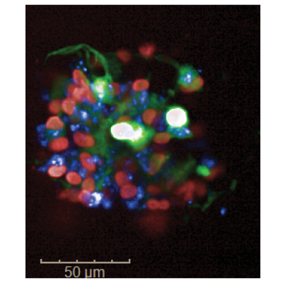 A 3D spheroid culture of human neural stem cells imaged on a high-throughput confocal microscope with nuclei shown in red and amyloid plaques in blue.