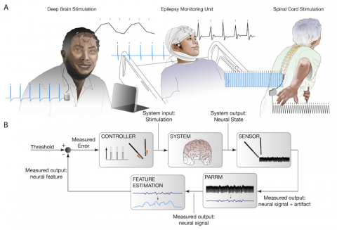 Brain stimulation