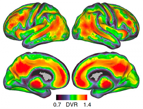 Brain scan diagram