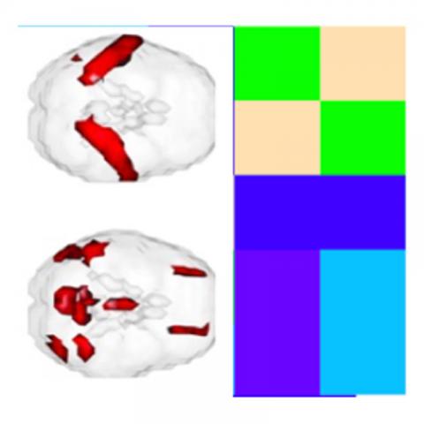 Brain diagram