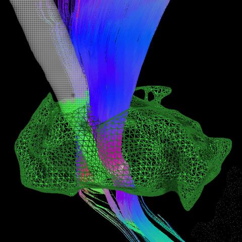 3D model of the brain