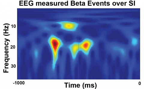 EEG graph