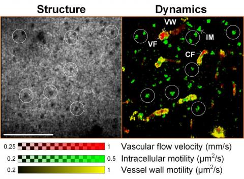 Vascular flow diagram