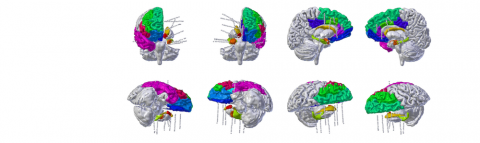 3D brain rotating