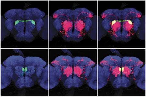 Brain scans