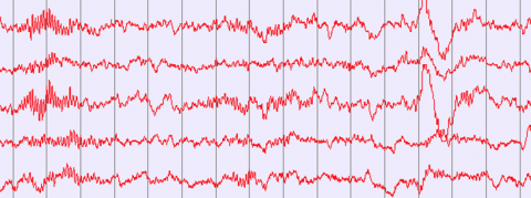 stage 2 sleep EEG