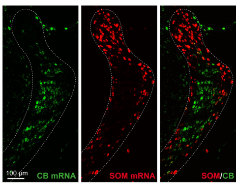 Zones of neurons