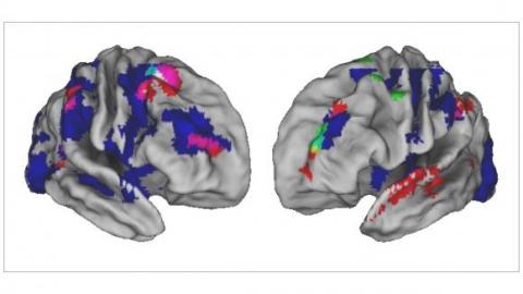 Brain scan